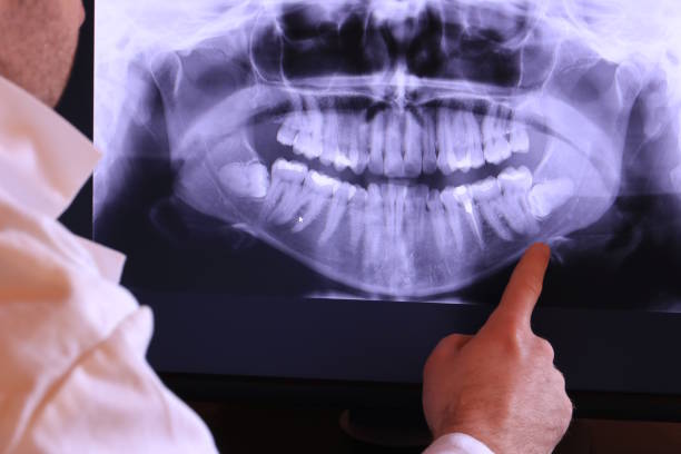 Best Emergency Treatment for Toothache in Royal Pines, NC